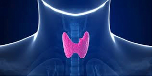 disfagia tiroide