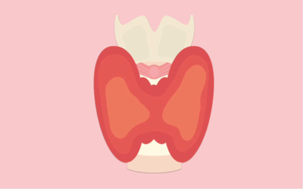 noduli tiroidei maligni