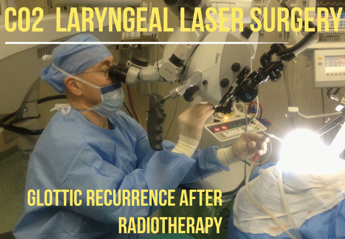 Laserchirurgia laringea