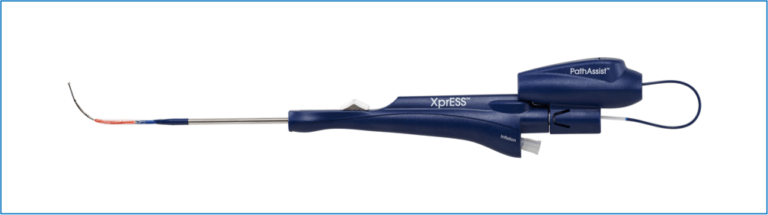 Senotomia Frontale Dilatativa con  XPRES BALLOON (Entellus®)