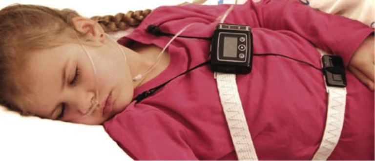 Polisomnografia nei disturbi respiratori del sonno in età pediatrica. Non sempre solo Apnee Ostruttive