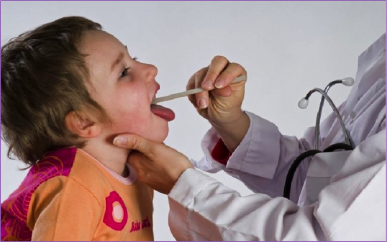 Indicazioni alla Tonsillectomia in età pediatrica