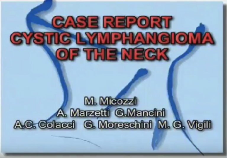 Caso clinico: Lymphangioma Cistico del Collo