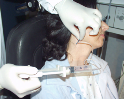 Tumori delle ghiandole salivari: confronto agoaspirato e agobiopsia