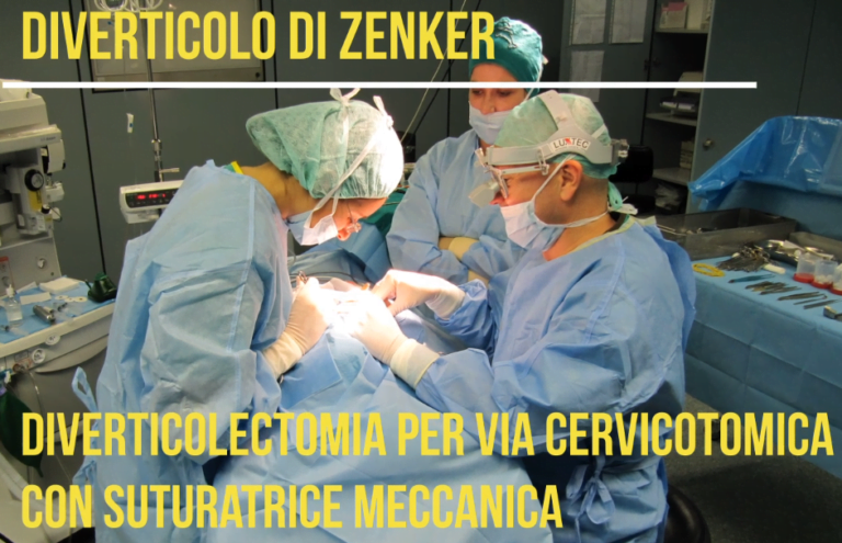diverticolo di zenker