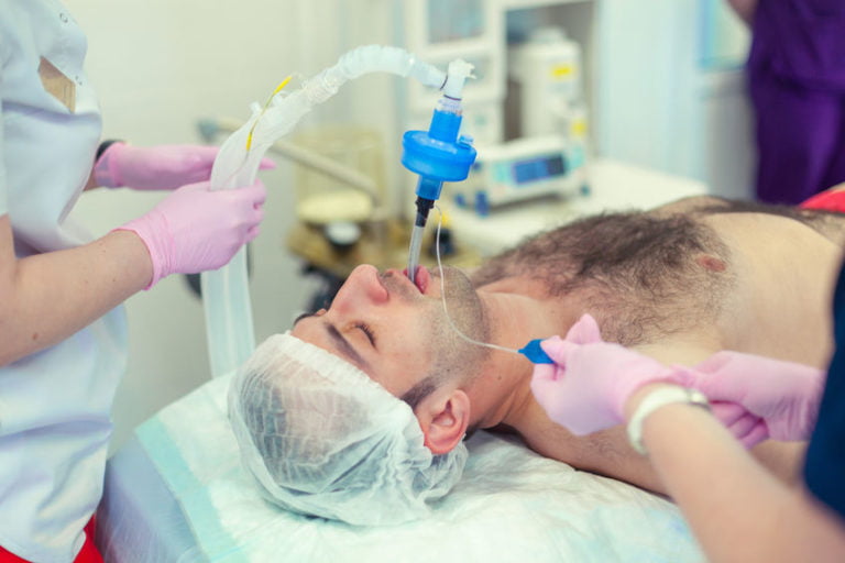 deglutizione dopo estubazione