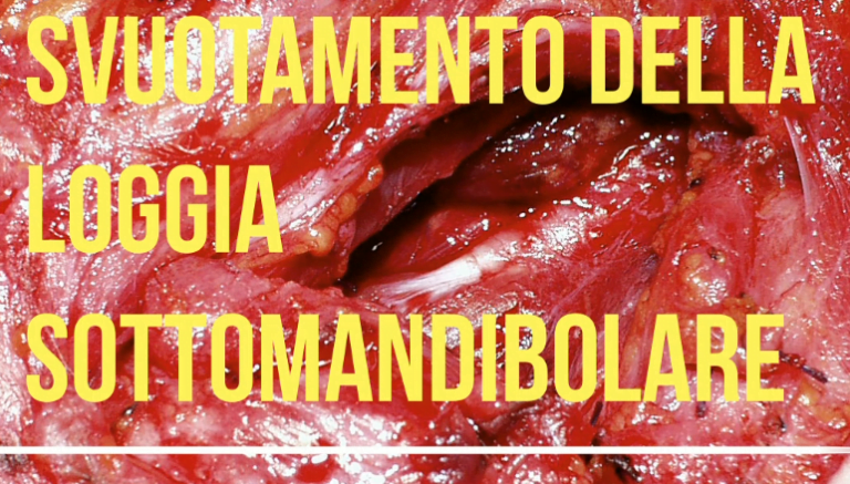 svuotamento loggia sottomandibolare