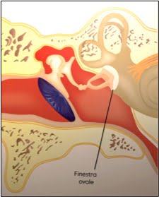 Gravidanza, esposizione agli estrogeni e otosclerosi