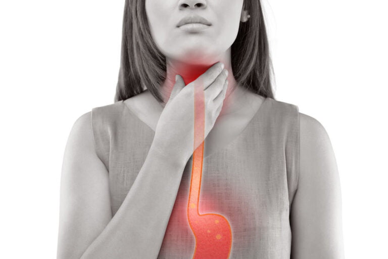 Il reflusso faringo laringeo rallenta la guarigione dei sintomi post tiroidectomia totale