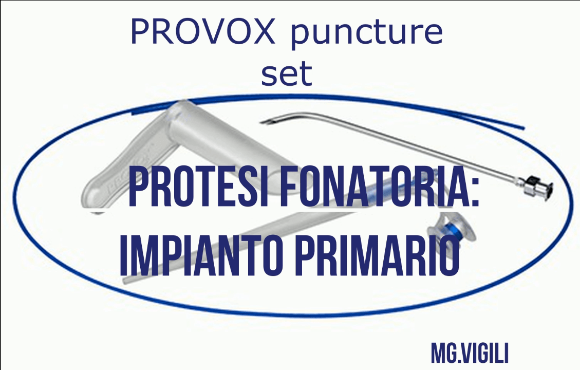 protesi fonatoria