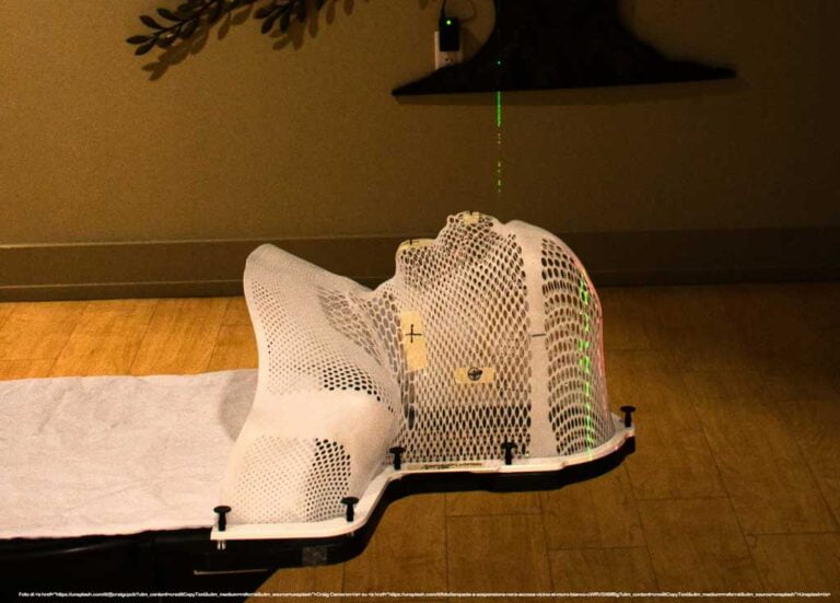 potenziale impatto della radioterapia