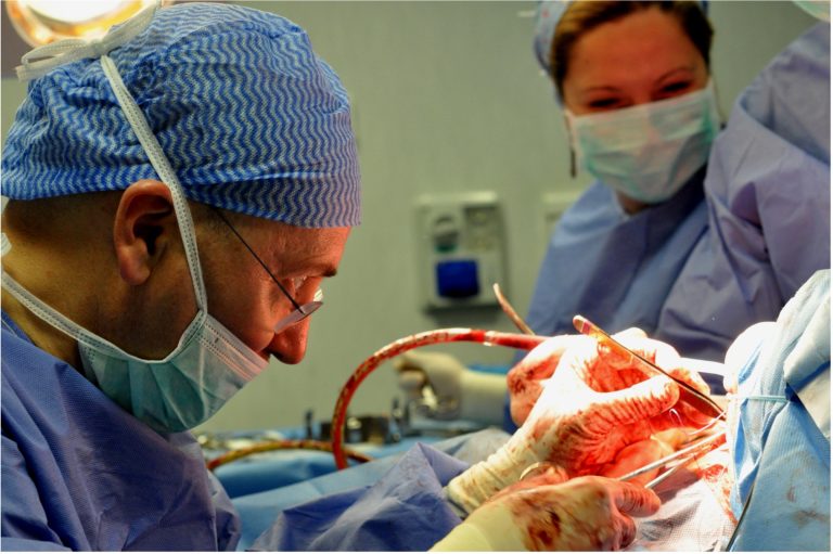 svuotamento latero cervicale sopraomoioideo