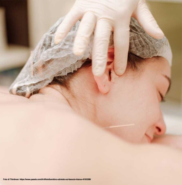 agopuntura nel trattamento degli acufeni