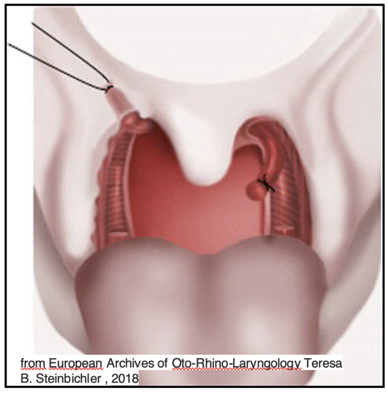 risultati clinici osas