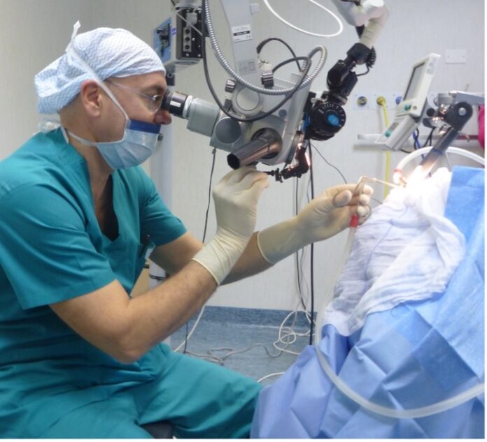 cordectomia di iii tipo