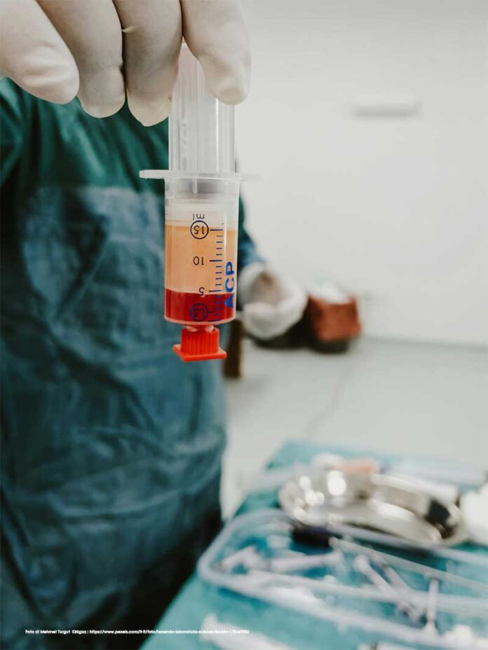 uso del prp in otorinolaringoiatria