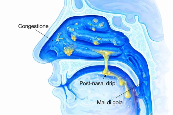 post nasal drip chatgpt image 12 feb 2026, 16 30 42