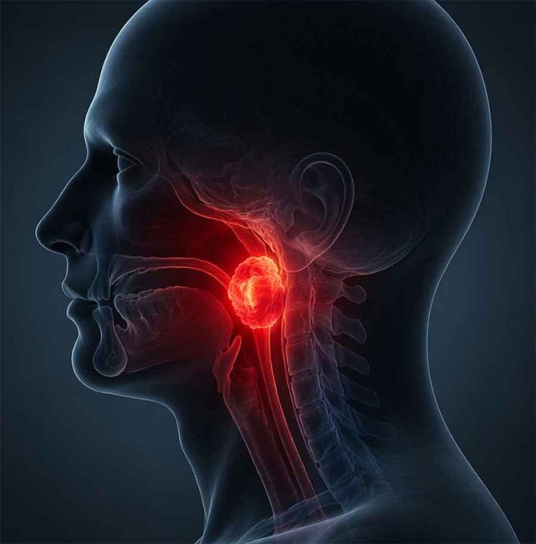tumori della testa e del colllo chatgpt image 15 apr 2026, 15 51 02
